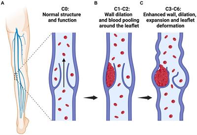 Sustainable varicose vein therapy using functionalized hydrogels derived solely from livestock waste